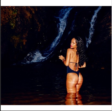 Brazilian Butt Lift?