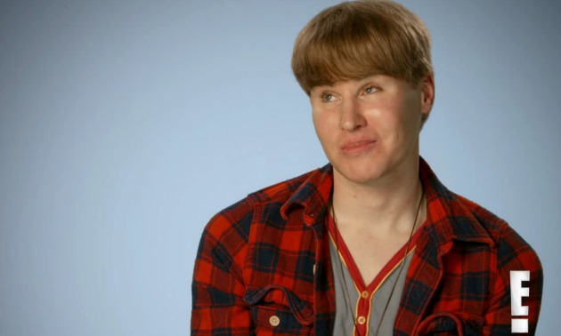 justin bieber botched