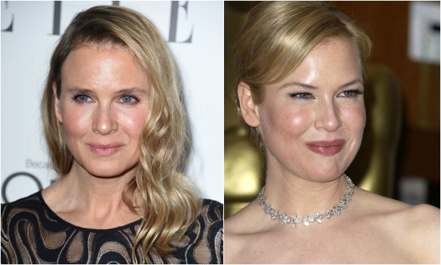 renee-zellweger