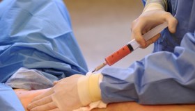 Triple board certified plastic surgeon Dr. David Broadway injects the fat from the back and buttocks back into the breasts of patient Sherri Frie. About 400 cubic centimeters of fat was re-injected into each breast. Each of these syringes holds about