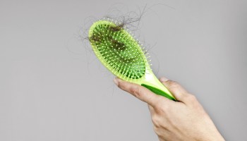 Woman losing hair on hairbrush