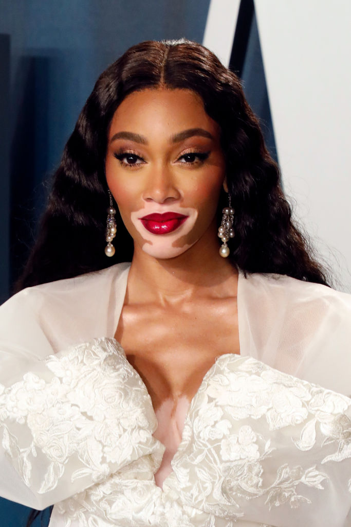 Winnie Harlow