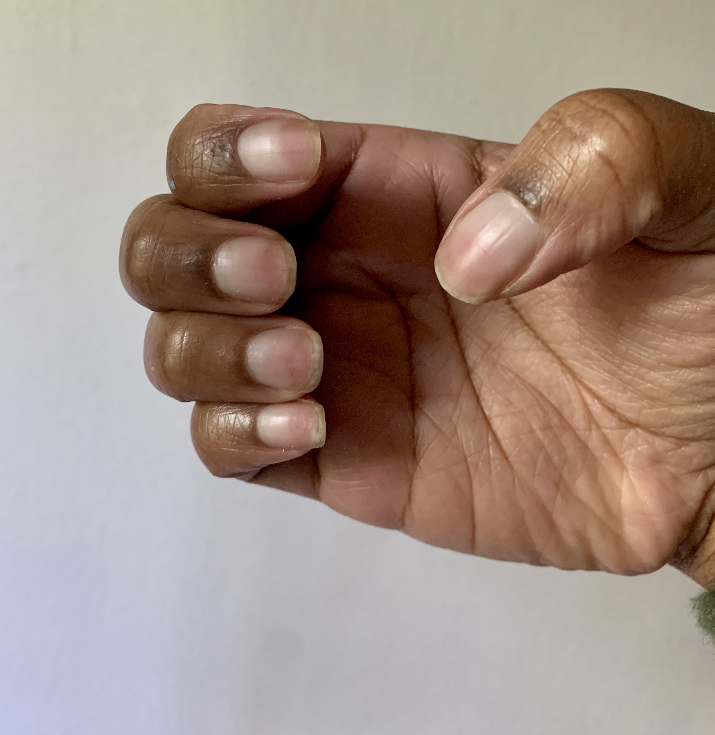 Before and After nail images