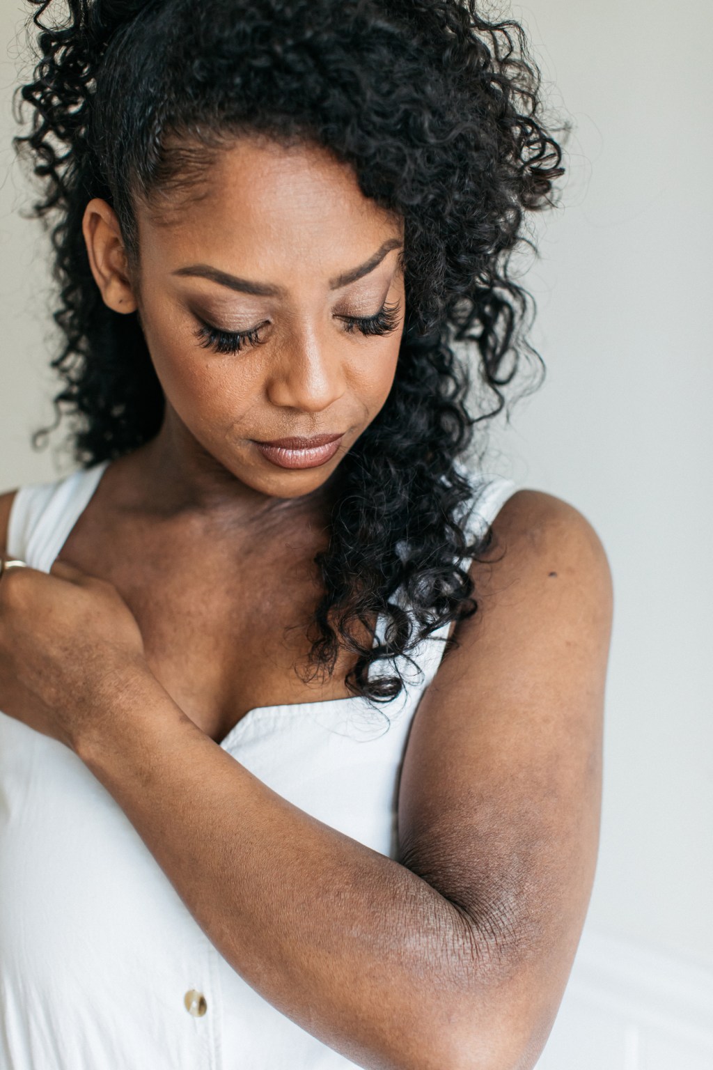 Embracing my skin, my eczema