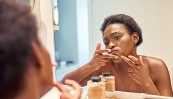Is skin problems ruining your day?