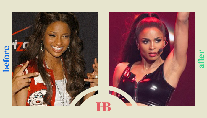 Ciara's Before and After "Plastic Surgery"