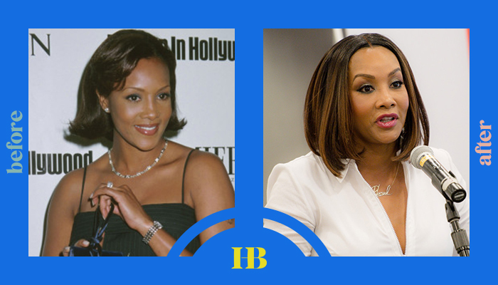 Vivica A. Fox's Before and After "Plastic Surgery"