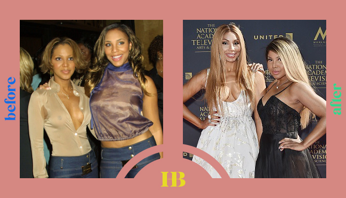 Toni and Tamar Braxton's Before and After "Plastic Surgery"