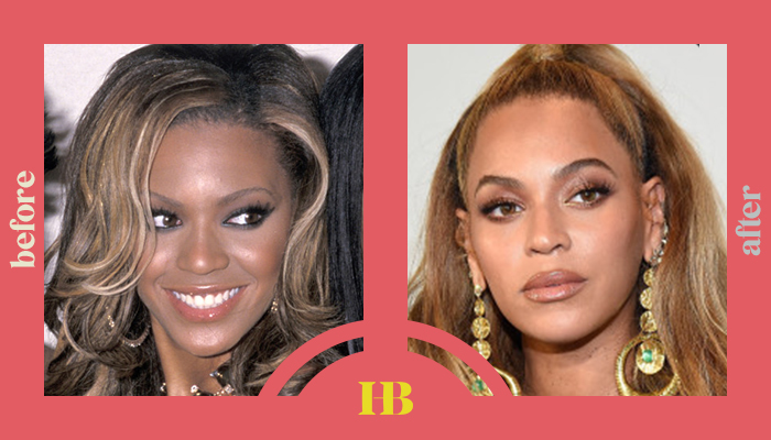 Beyonce's Before and After "Plastic Surgery"
