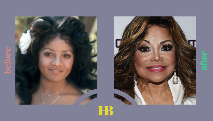 Latoya Jackson's Before and After "Plastic Surgery"