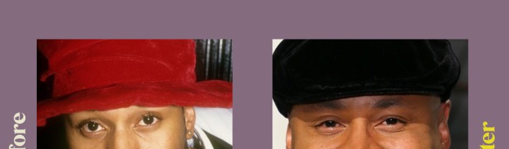 LL Cool J's Before and After "Plastic Surgery"