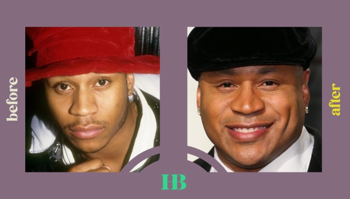 LL Cool J's Before and After "Plastic Surgery"