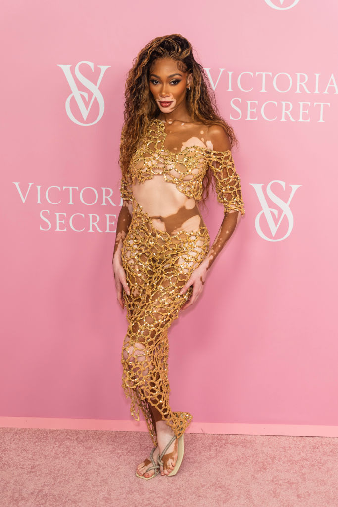 Winnie Harlow